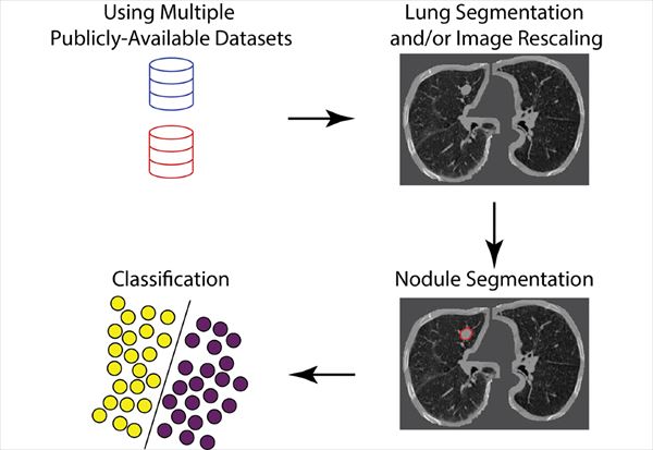 A model of the informatics workflow used by most teams. In addition to the Kaggle training set, most teams obtained additional publicly available datasets with annotations. Lung segmentation, image rescaling, and nodule segmentation modules were commonly used before classification.